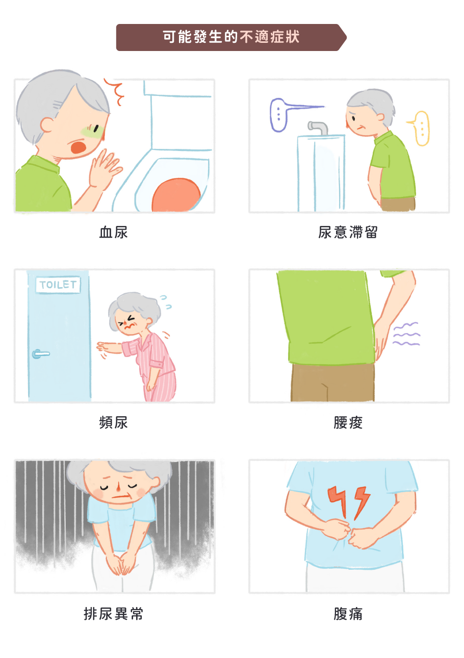 腎結石常見症狀：血尿、頻尿、排尿異常、尿意滯留、腰痠、腹痛等現象